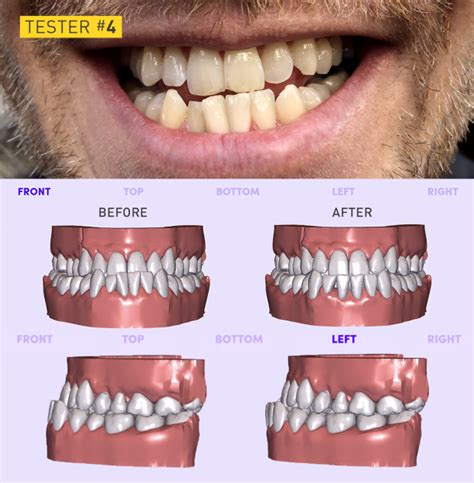 smile direct club results|SmileDirectClub Reports First Quarter 2023 Financial Results.